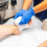 imageye___-_imgi_46_Nurse+putting+foot+bandages+on+a+leg+wound
