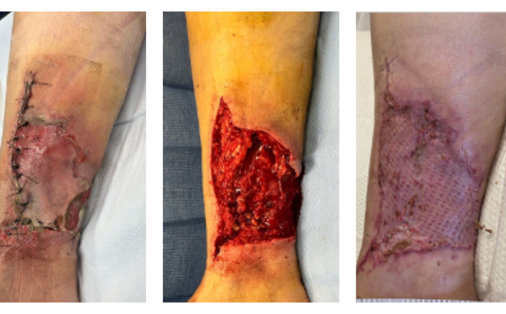 imageye___-_imgi_51_Wound+1